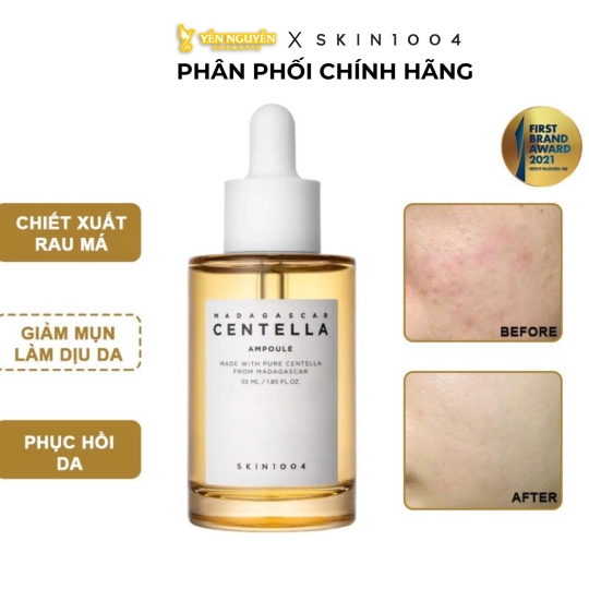 Tinh Chất Skin1004 Madagascar Centella Ampoule Dành Cho Mụn Nhạy Cảm 55ml